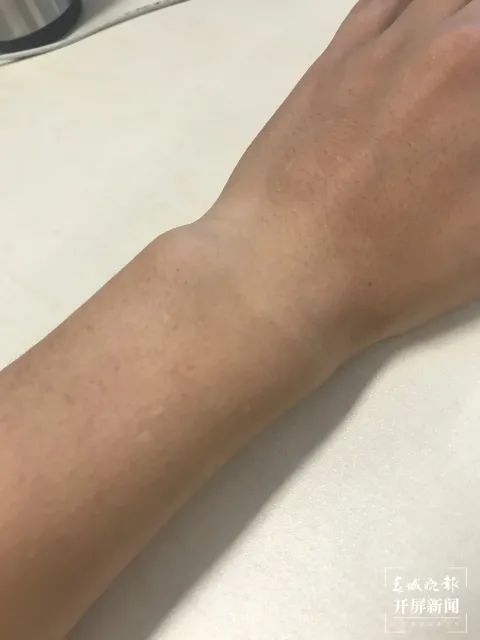 先奉上小编本人健康无比的肤色随手一拍云南的紫外线到底有多强?