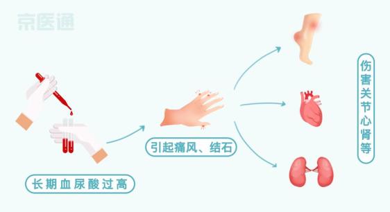 血压表什么牌子的好血压、血糖、血脂…标准对照表来了！还有忌口清单，快收好_https://www.jmylbn.com_新闻资讯_第10张