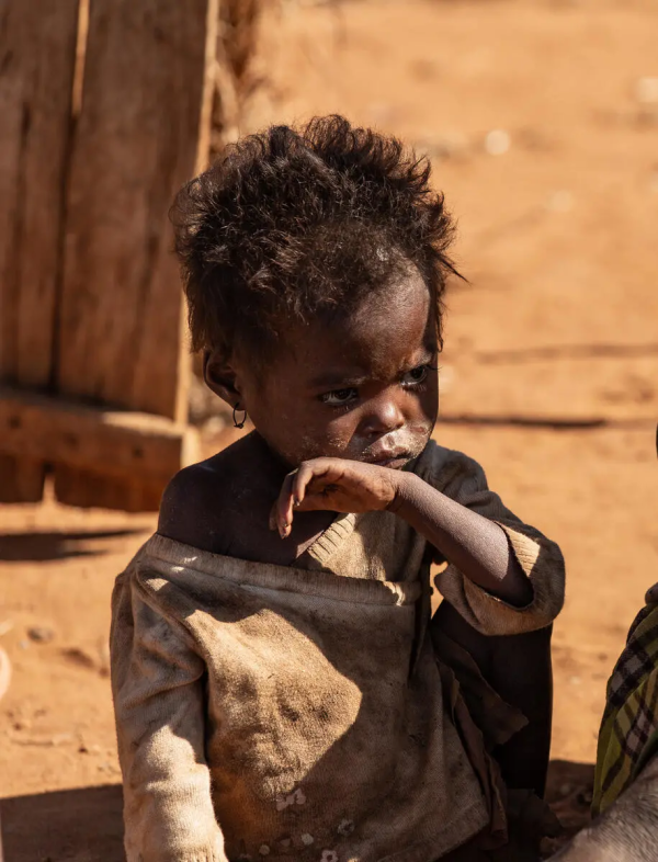 非洲吃不上饭小孩图片图片