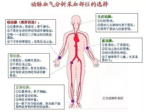 抽血气图解图片