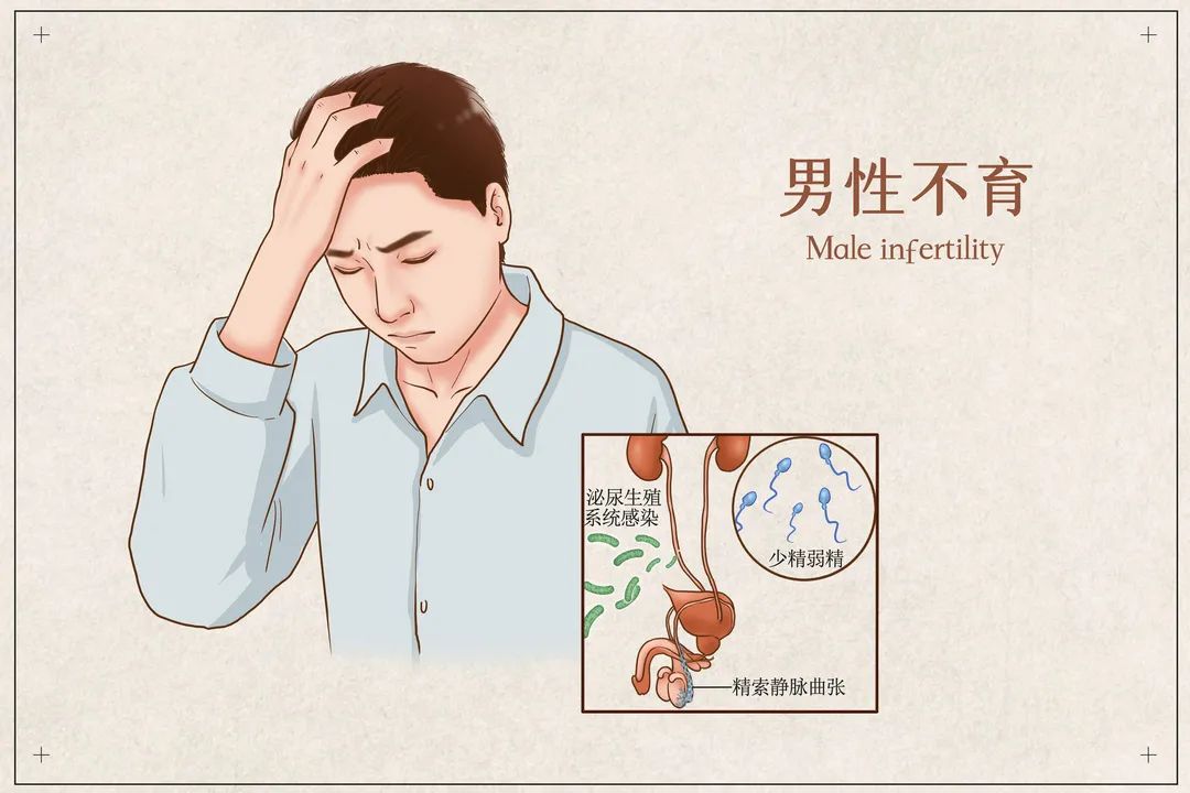 为什么查不孕不育建议先查男性需要做哪些项目你知道吗