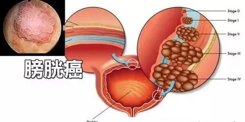 不要忽略身體的