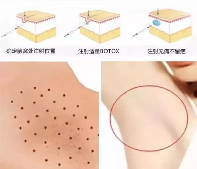 你的腋下有榴莲吗