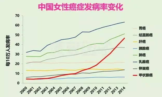 女性患病率是男性的3倍得了甲狀腺結節應該怎麼辦