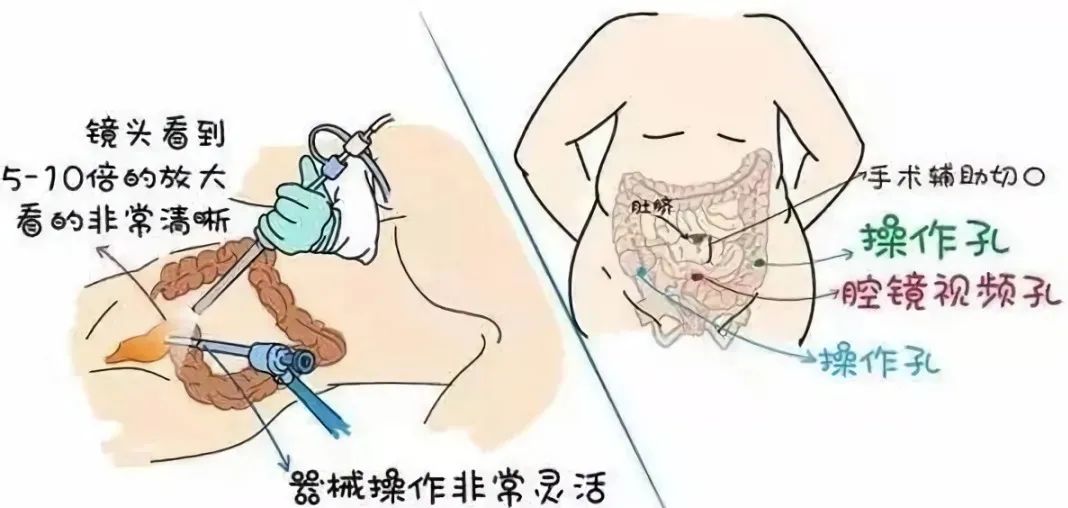 医生，B超提示我有子宫畸形……(图9)