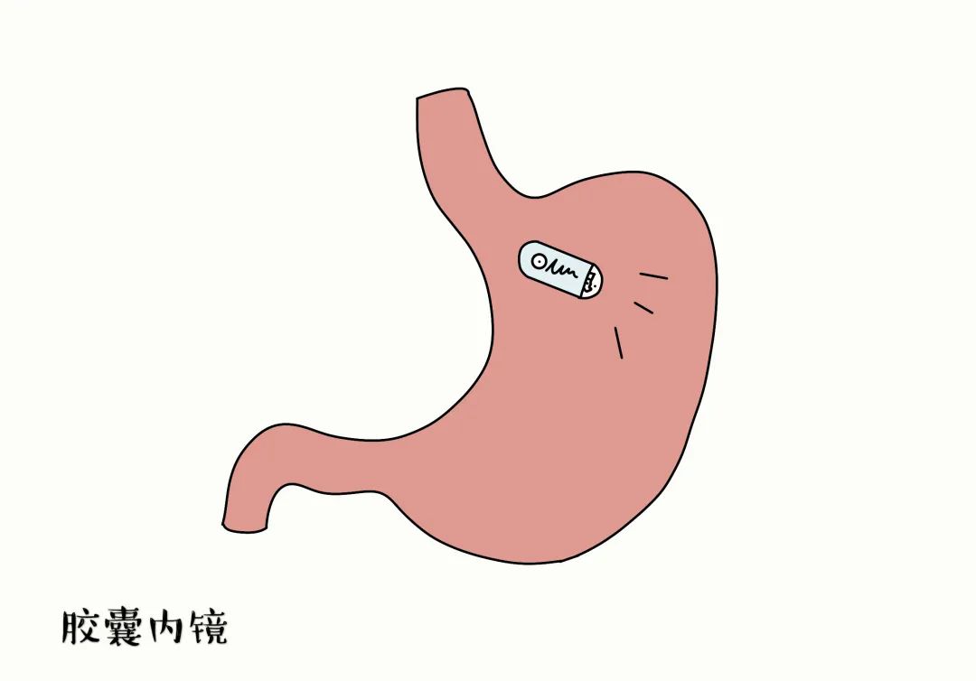 胃镜卡通图片