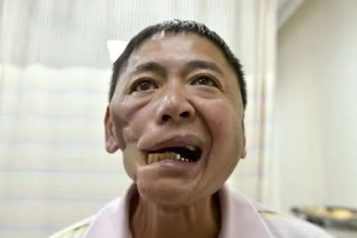 吃槟榔的人脸图片图片
