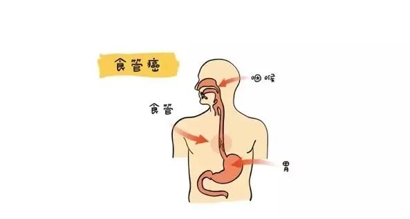 食管疼痛位置图图片