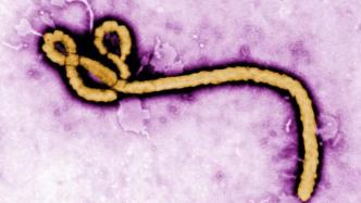 埃博拉疫苗，为什么会被搁置数十年？