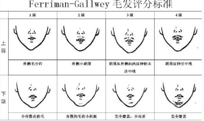 【生殖科陈虹大夫说】如何判断是否患上多囊卵巢综合征?