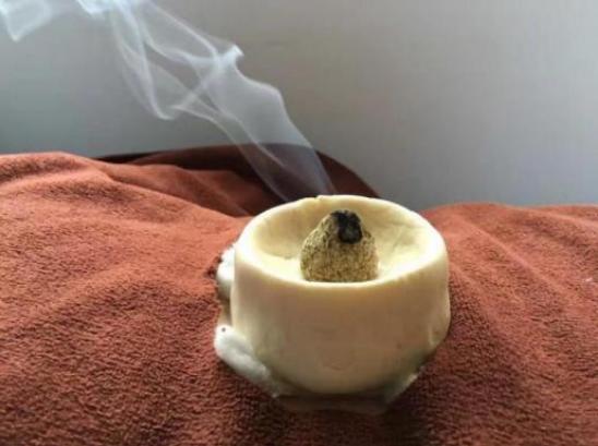 9,五行灸是针对穴位和体表部位的精准定位进行治疗,主要治疗:腹痛