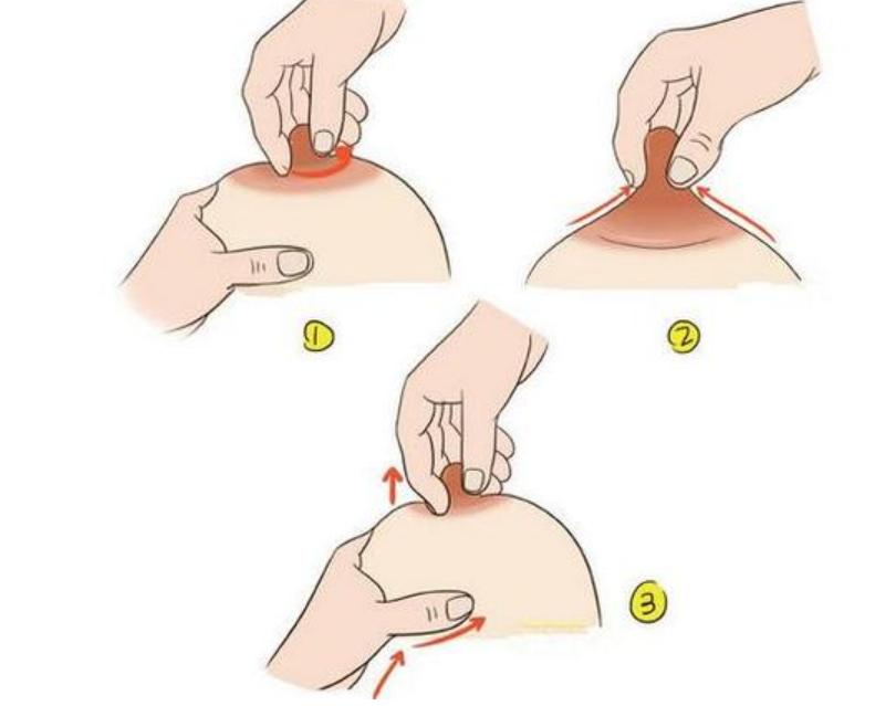 世界母乳喂养周乳头凹陷如何成功母乳喂养