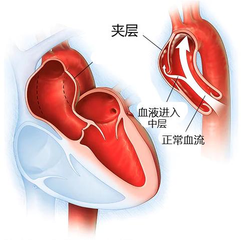 为了拆弹我爸的心脏停跳了好几个小时