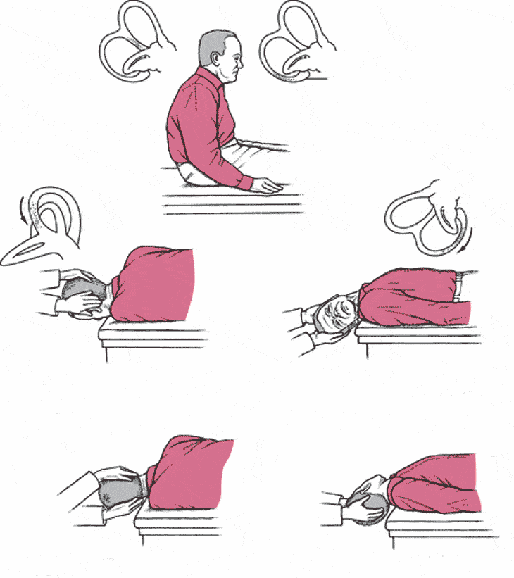 如何预防耳石症呢?