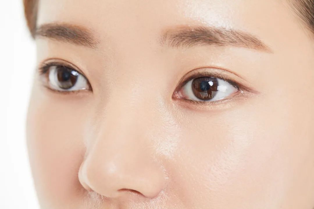 想割双眼皮有一个问题要先搞清楚