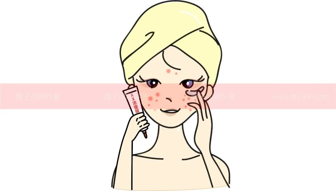 浦人医科普爱美人士切勿随意刷酸治疗