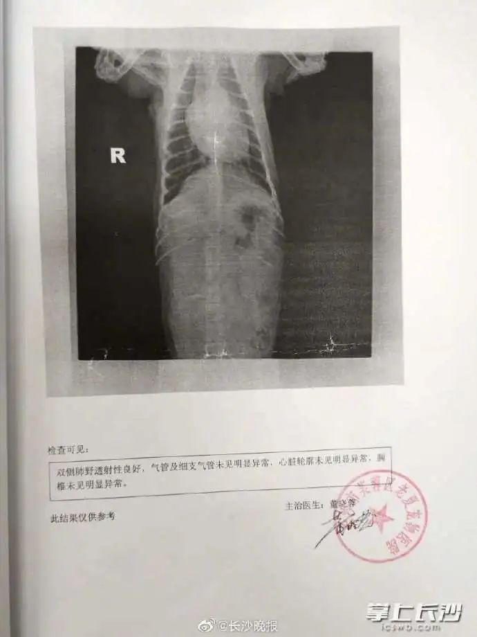 遛狗不拴绳致狗撞车,狗没事车损坏,法院:狗主人赔偿维修费 遛狗不拴绳致狗撞车,狗没事车损坏,法院:狗主人赔偿维修费