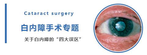 关于白内障的 四大认知误区 你中招了几个