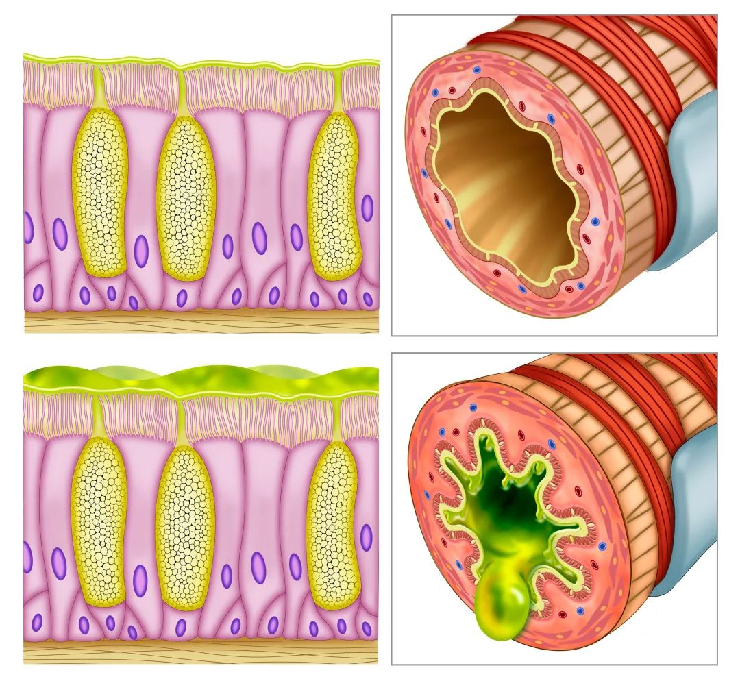 结肠杯状细胞图片