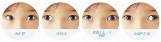 每天看手机超5小时然后眼睛斜了