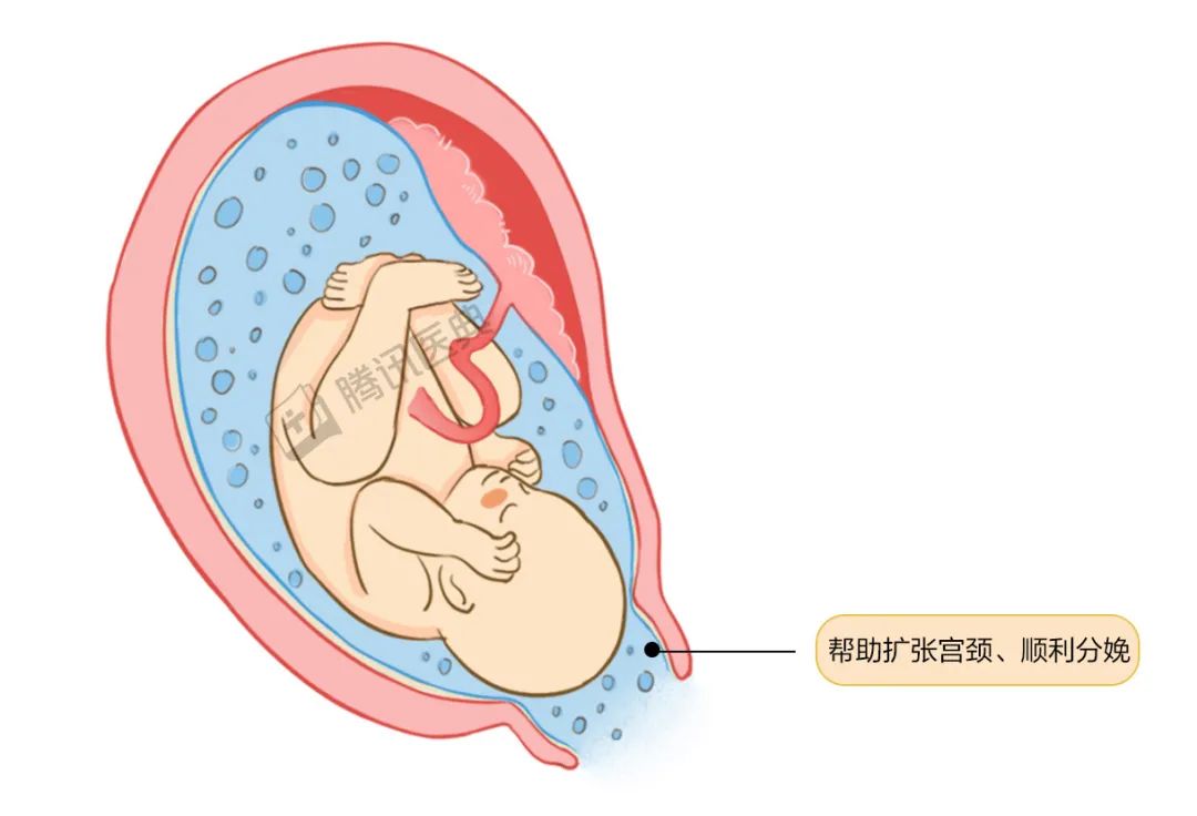 胎盘图片 子宫羊水图片