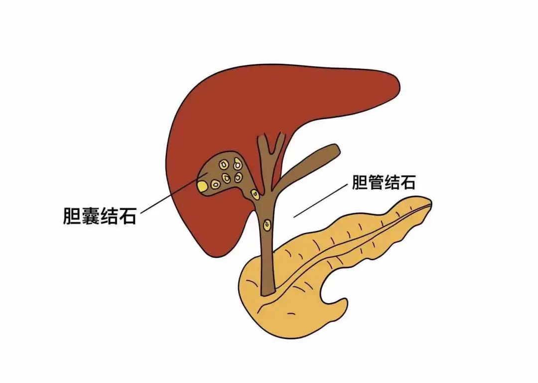 胆囊的形状图图片