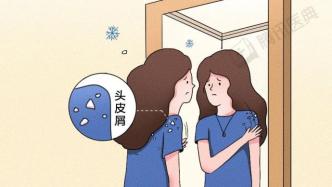 消滅頭皮屑，我用了這3個秘密武器