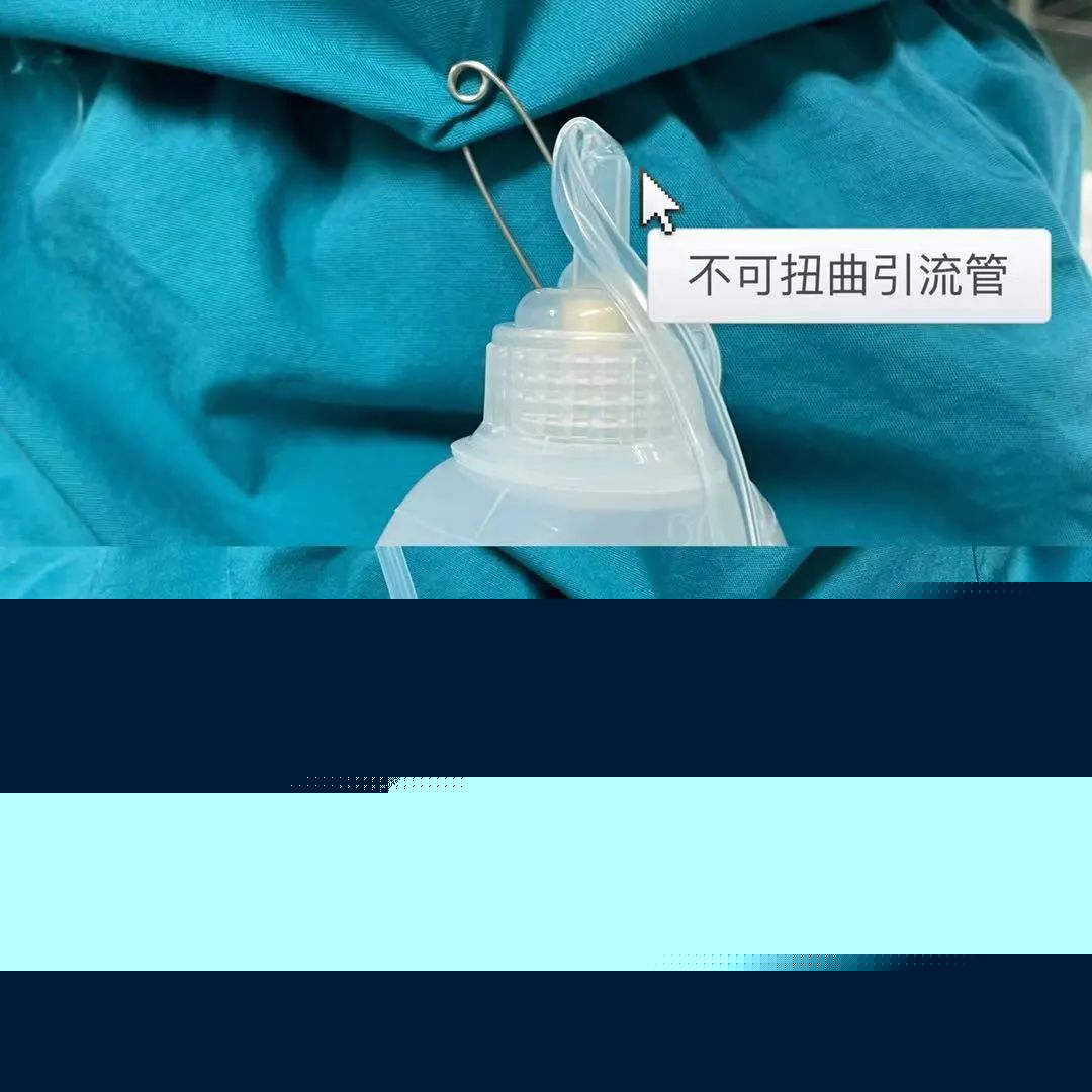 为什么要放负压球带引流球出院，你该这么做_https://www.jmylbn.com_新闻资讯_第4张
