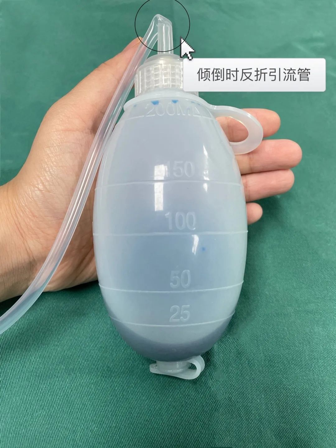 为什么要放负压球带引流球出院，你该这么做_https://www.jmylbn.com_新闻资讯_第5张