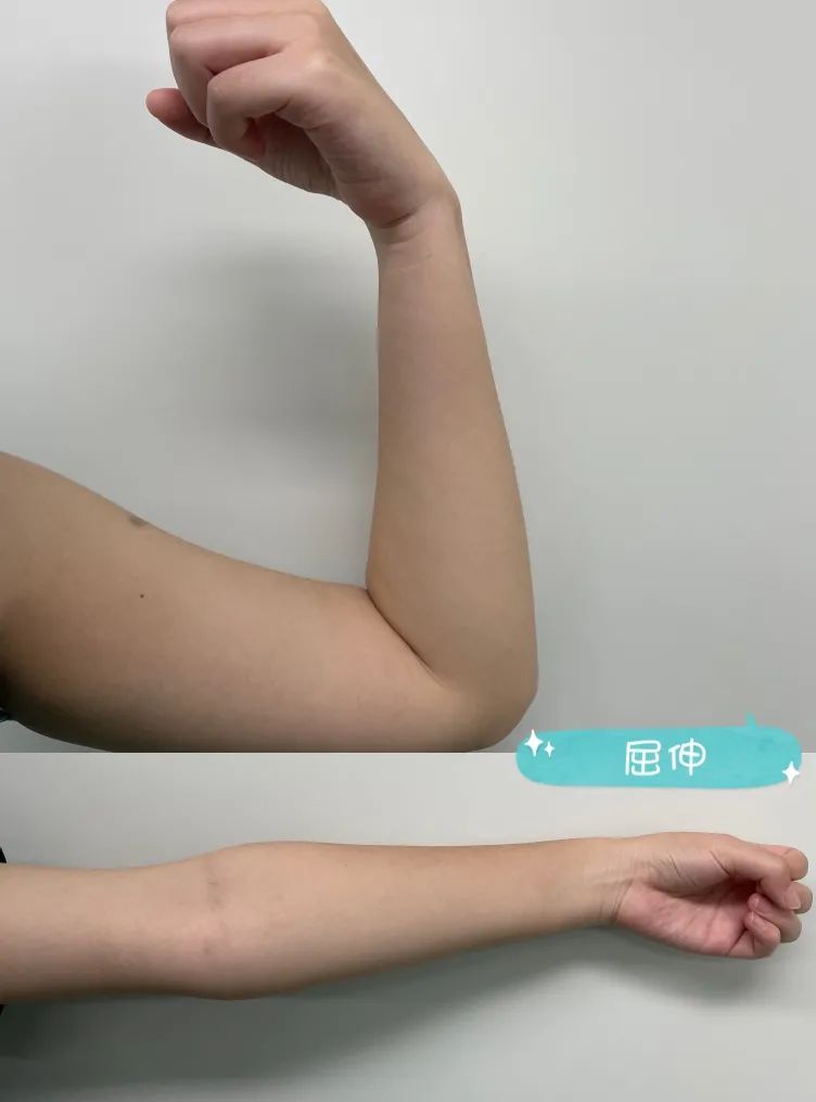 为什么要放负压球带引流球出院，你该这么做_https://www.jmylbn.com_新闻资讯_第9张