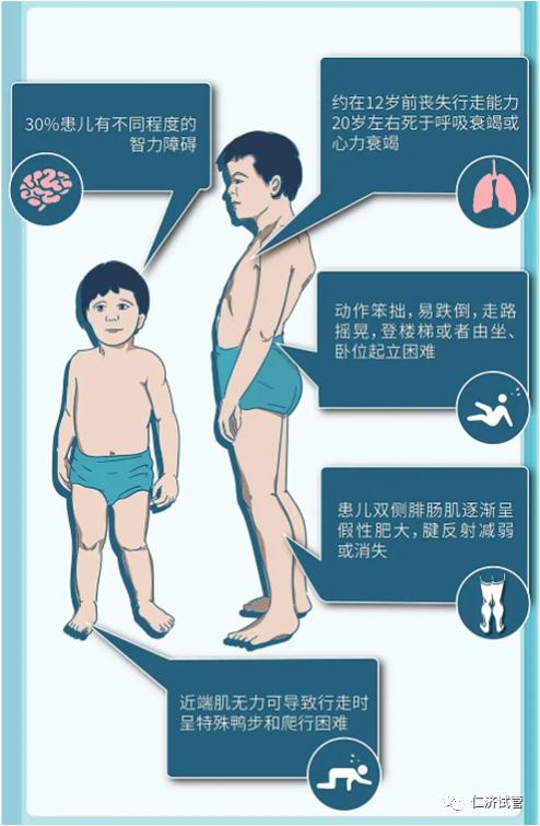 dmd患儿通常在3岁~4岁时开始表现出步态异常,在10岁~12岁时逐渐丧失