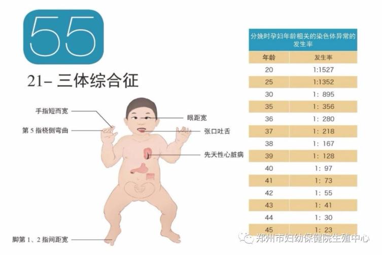 18三体综合征图片