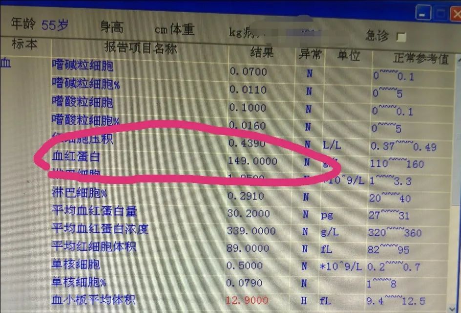 55岁服用阿司匹林引起胃出血病情危重如何避免胃出血
