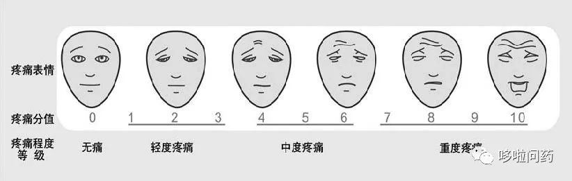 面部表情疼痛评分量表:适用于老年人,儿童,以及存在语言或文化差异或