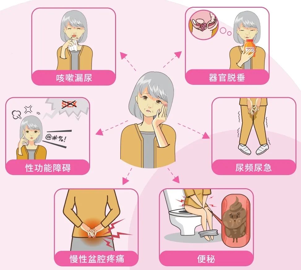 关爱女性朋友——上海邮电医院妇科引入"盆底康复治疗"技术