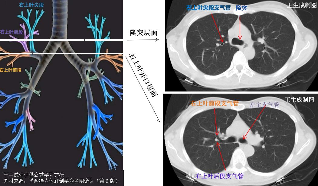 肺上界位置图图片