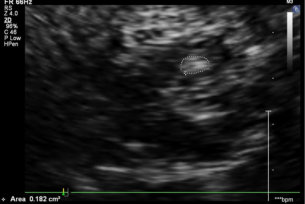 新技术新能力新服务您帕了吗黑质超声来诊断