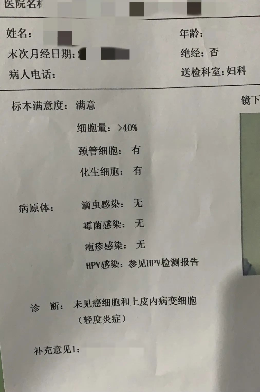 超过21岁有性生活的女生请定期做这项妇科检查