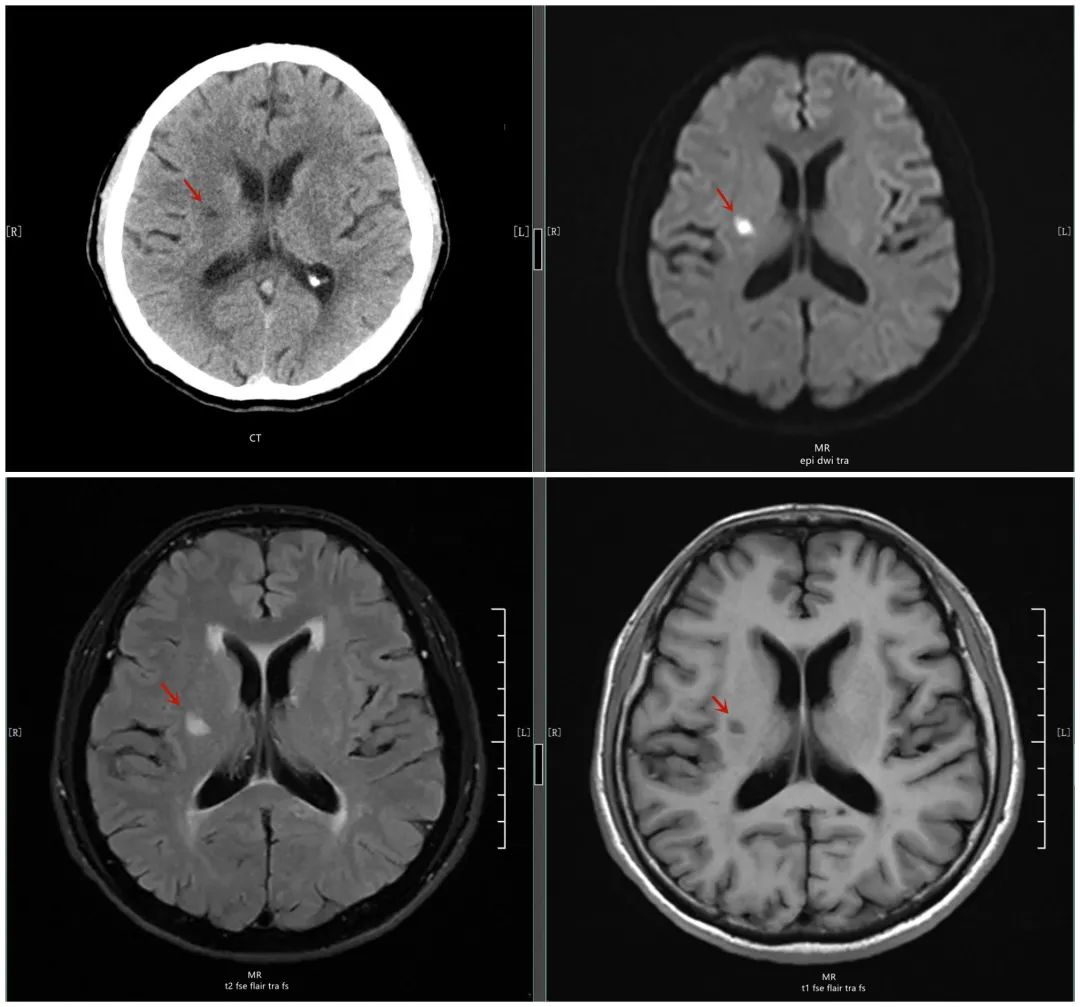 脑磁共振扫描显示CT拍片片子脑部大脑_4096X2160_高清视频素材下载(编号:7666624)_影视包装_光厂(VJ师网) www ...