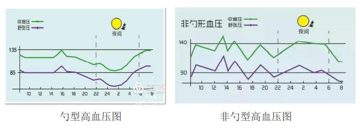 超勺型血压图片