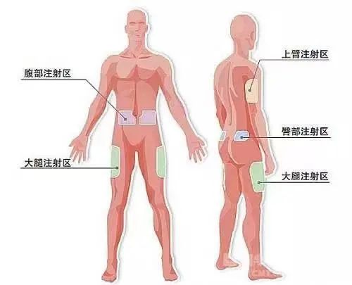 臀部肌肉注射的安全区图片
