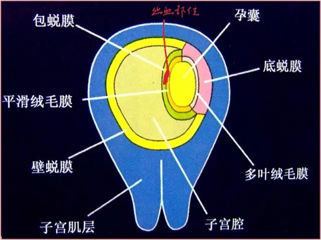 怀孕初期绒毛组织图片图片