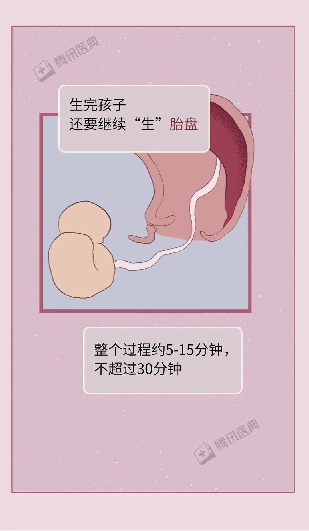 分娩机制是什么意思 过程包括哪些