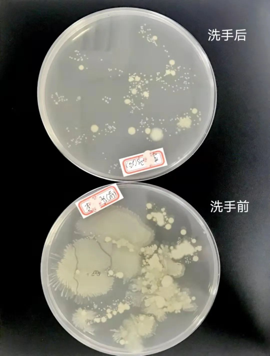 洗手前后细菌对比图片