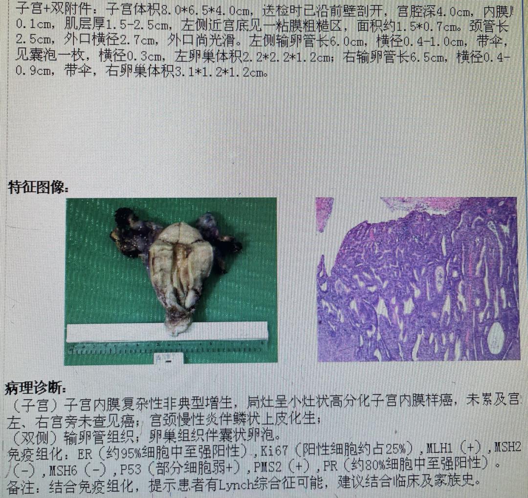 宫颈息肉病理报告图片