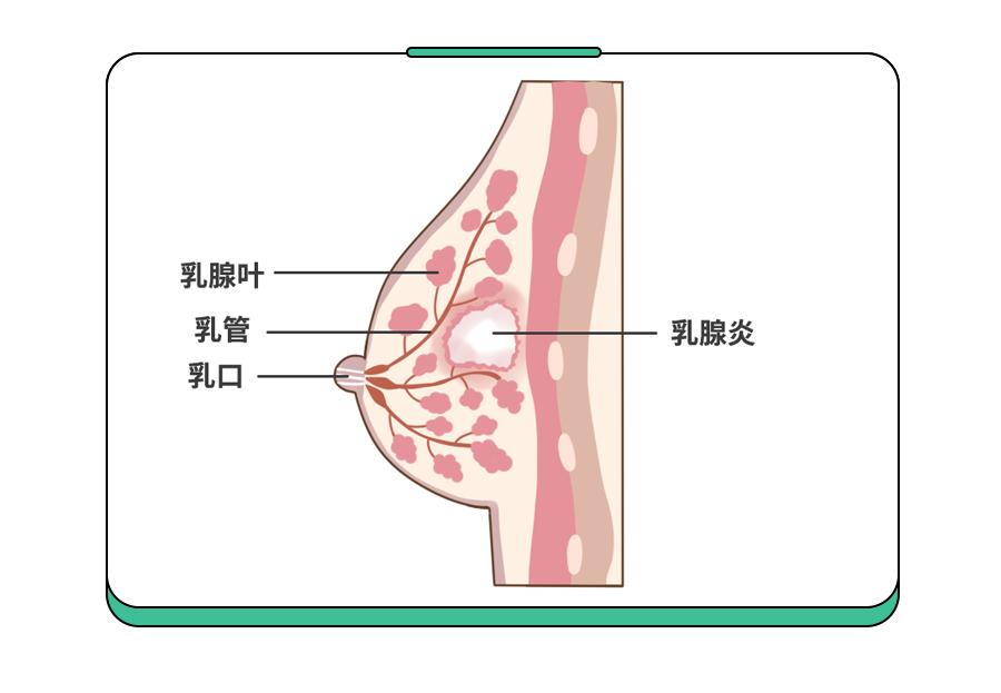 比生娃还痛