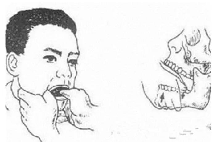 为什么牙医不用开口器掉下巴更惨的其实是牙医_https://www.jmylbn.com_新闻资讯_第8张