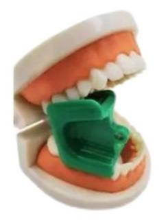 为什么牙医不用开口器掉下巴更惨的其实是牙医_https://www.jmylbn.com_新闻资讯_第12张