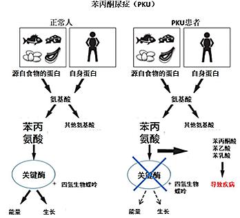 苯丙酮酸尿症图片