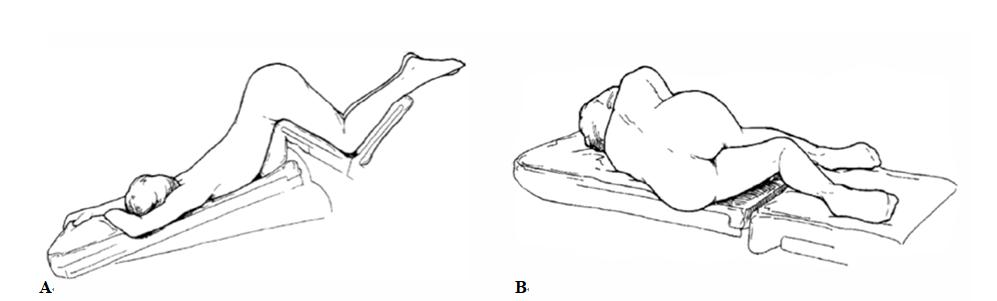 一次性肛门镜怎么检查结直肠肛门疾病的诊断——体格检查_https://www.jmylbn.com_新闻资讯_第11张